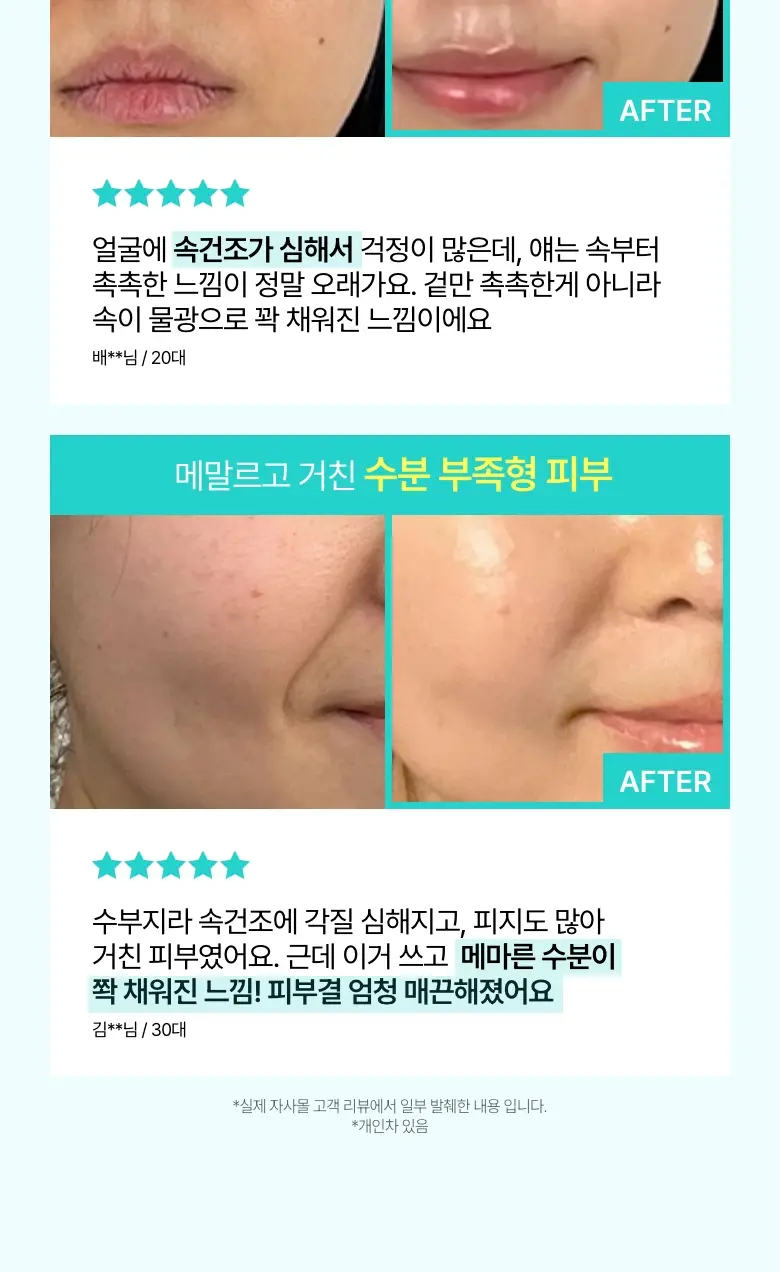 [단독기획] 아누아 피디알엔 히알루론산 캡슐 100 세럼 30ml 더블 기획 상세페이지 7